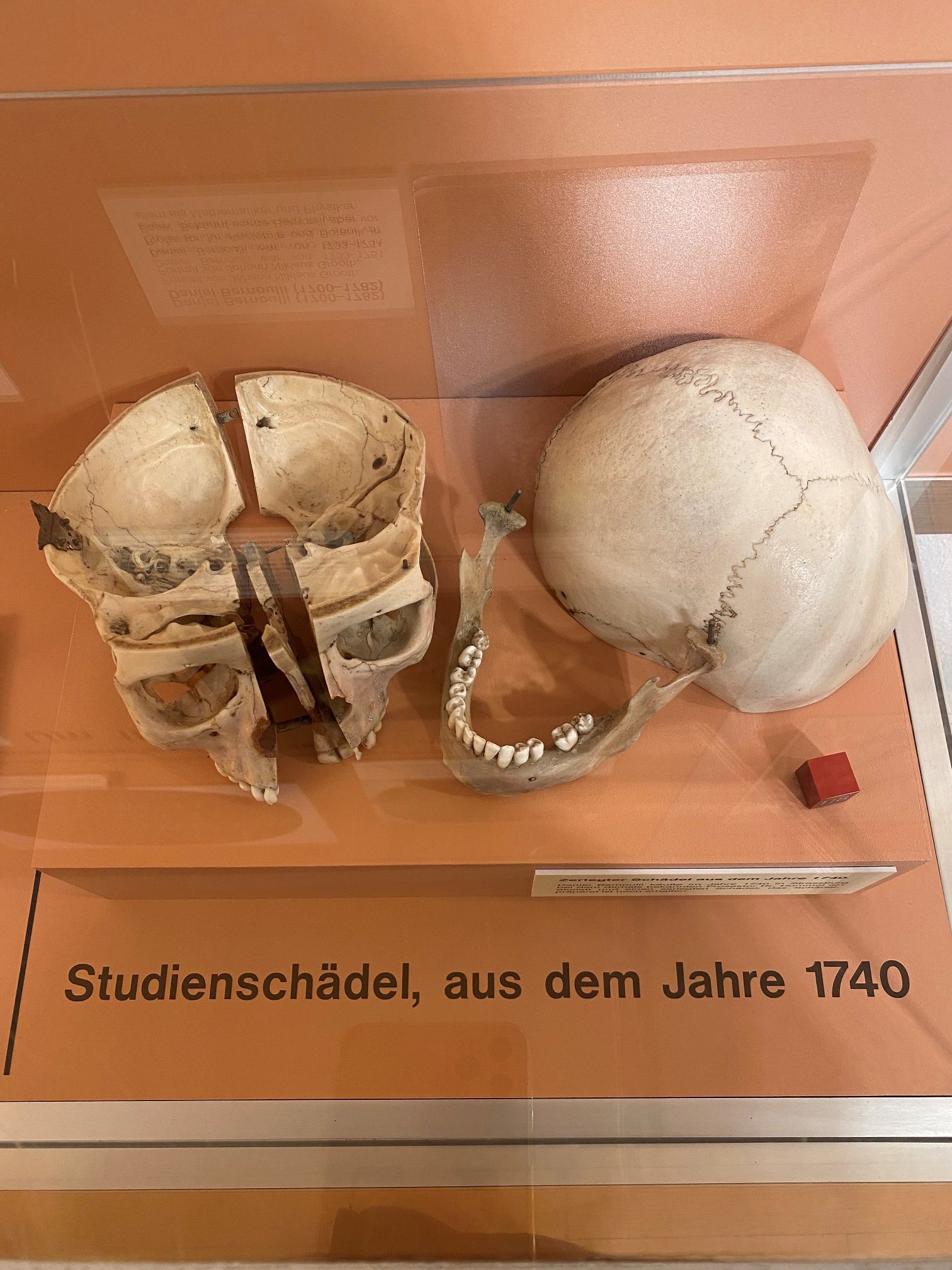 Study-skull (1740), Anatomischen Museums, Basel (by Irene Cardiello).jpeg